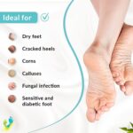 Fixderma Foobetik Cream, Foot cream, 50g For Dry & Cracked Feet, Calloused or Chapped Skin - Image 4