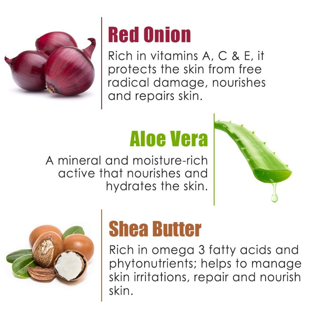 WOW Skin Science Red Onion Face Cream - Oil Free, Quick Absorbing - For All Skin Types - No Parabens, Silicones, Color, Mineral Oil & Synthetic Fragrance - 50 ml - Image 5