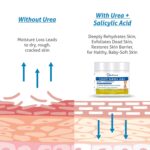 Dr Foot, Foot Heel Gel 20% Urea and 1% Salicylic Acid Moisturizes Callus Cracked Rough Dry Dead Skin and Corns Softens Thick Painful Nails - 100gm - Image 9