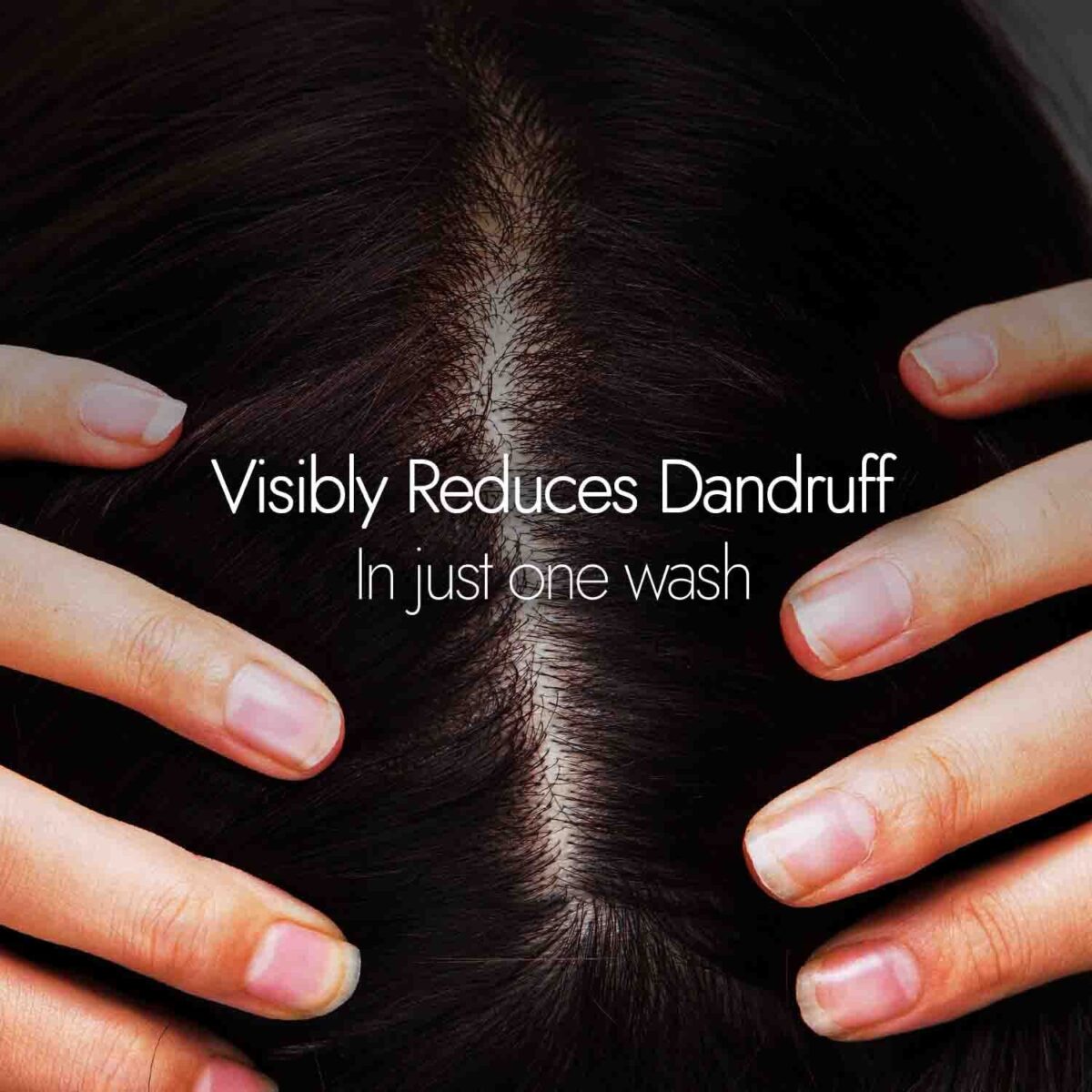 Kapiva Dandruff Control Neem Triphaladi Shampoo 250ml for Helps to reduce mild to heavy dandruff - Image 2