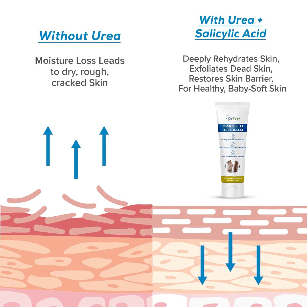 Dr Foot Cracked Heel Balm with Urea, Aloe Vera Gel & Tea Tree Oil for Rough, Thick, Dry, Cracked Skin | Cure and Moisturizes for Healthy Feet – 50gm - Image 6