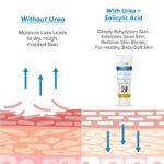 Dr Foot Cracked Heel Balm with Urea, Aloe Vera Gel & Tea Tree Oil for Rough, Thick, Dry, Cracked Skin | Cure and Moisturizes for Healthy Feet – 50gm - Image 6