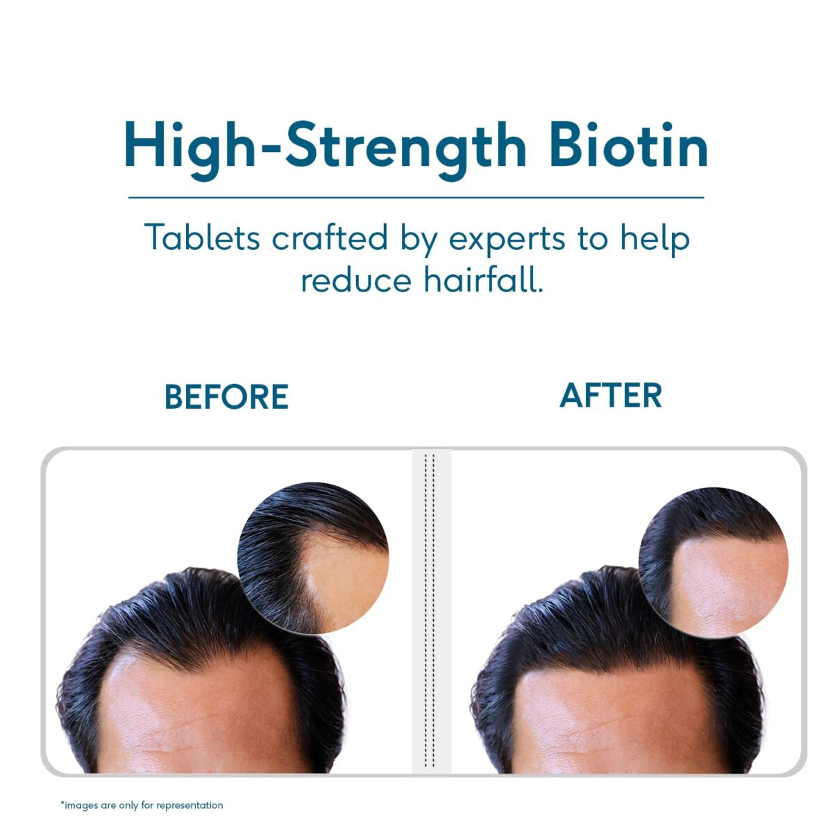 HealthKart HK Vitals Biotin, Supplement for Hair Growth, Strong Hair and Glowing Skin, Fights Nail Brittleness, 90 Biotin Tablets - Image 5